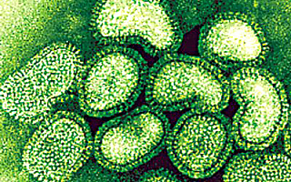 Cztery przypadki zachorowań na świńską grypę